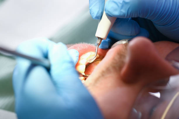 Best Urgent Care for Lost Fillings or Crowns in Fowler, MI